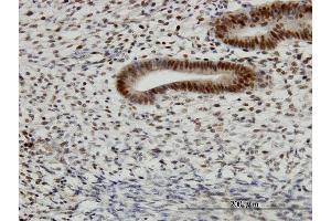 Immunoperoxidase of monoclonal antibody to TFAP4 on formalin-fixed paraffin-embedded human endometrium. (TFAP4 antibody  (AA 93-192))