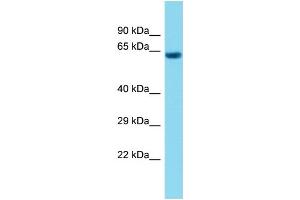 Host: Rabbit Target Name: C1orf94 Sample Type: Fetal Heart lysates Antibody Dilution: 1. (C1ORF94 antibody  (C-Term))