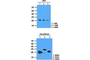 Western Blotting (WB) image for anti-GTPase NRas (NRAS) antibody (ABIN781534)