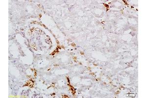 Formalin-fixed and paraffin embedded mouse kidney labeled with Anti AAK1 Polyclonal Antibody, Unconjugated  at 1:200 followed by conjugation to the secondary antibody and DAB staining (AAK1 antibody  (AA 301-400))