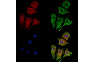 ABIN6261731 and ABIN6269136 staining HepG2 cells by IF/ICC.