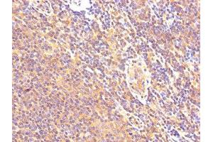 IHC image of ABIN7146551 diluted at 1:500 and staining in paraffin-embedded human lymph node tissue performed on a Leica BondTM system.