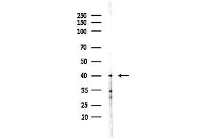 anti-Calcium Binding Protein 39 (CAB39) (C-Term) antibody