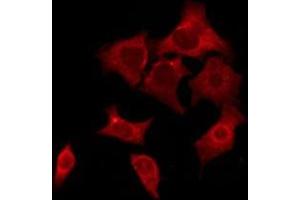 OR52E5 antibody