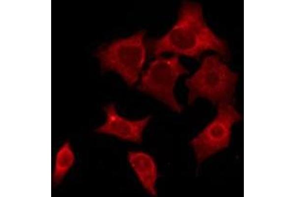 OR52E5 antibody