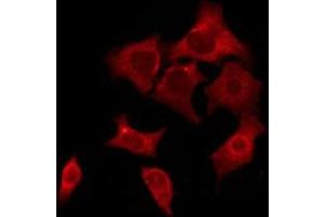 ABIN6276256 staining COLO205 by IF/ICC. (OR52E5 antibody)