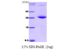 SDS-PAGE (SDS) image for Protein Phosphatase, Mg2+/Mn2+ Dependent, 1G (PPM1G) (AA 317-546) protein (His tag) (ABIN666863) (PPM1G Protein (AA 317-546) (His tag))
