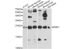 Western blot analysis of extracts of various cell lines, using DAD1 antibody. (DAD1 antibody)