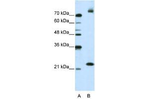 WB Suggested Anti-FZD9 Antibody Titration:  2. (FZD9 antibody  (N-Term))