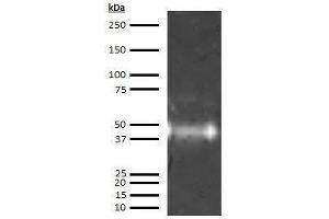 Western Blotting (WB) image for anti-Orosomucoid 1 (ORM1) antibody (ABIN613603) (ORM1 antibody)