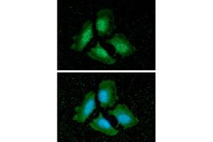 ICC/IF analysis of PPP1CA in HeLa cells line, stained with DAPI (Blue) for nucleus staining and monoclonal anti-human PPP1CA antibody (1:100) with goat anti-mouse IgG-Alexa fluor 488 conjugate (Green). (PPP1CA antibody)