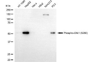 Western blotting analysis using phospho-Chk1 (S280) antibody (ABIN7798037).
