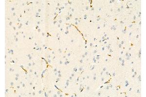 ABIN6265129 and ABIN6273163 at 1/100 staining Rat brain tissue by IHC-P.