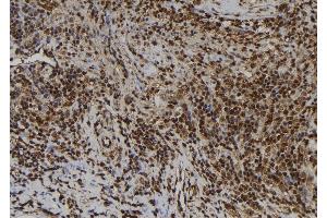 ABIN6277505 at 1/100 staining Human spleen tissue by IHC-P. (AIMP1 antibody  (Internal Region))