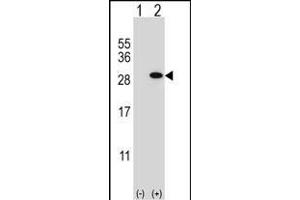 Western blot analysis of GSTT1 (arrow) using rabbit polyclonal GSTT1 Antibody (N-term) (ABIN656825 and ABIN2846035). (GSTT1 antibody  (N-Term))