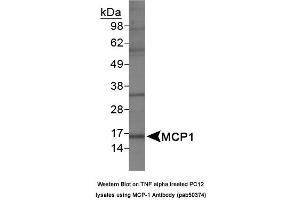 Image no. 1 for anti-Chemokine (C-C Motif) Ligand 2 (CCL2) (AA 30-80) antibody (ABIN363681) (CCL2 antibody  (AA 30-80))
