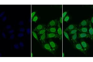 Detection of HDAC6 in Human HepG2 cell using Polyclonal Antibody to Histone Deacetylase 6 (HDAC6) (HDAC6 antibody  (AA 560-811))