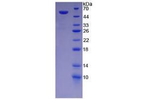 SDS-PAGE analysis of Human Desmoglein 1 Protein. (Desmoglein 1 Protein (DSG1))