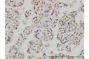 Immunoperoxidase of monoclonal antibody to FOXR2 on formalin-fixed paraffin-embedded human placenta.