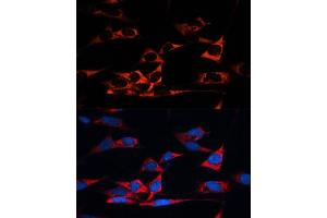 Immunofluorescence (IF) image for anti-Microtubule-Associated Protein 1B (MAP1B) (AA 1820-2100) antibody (ABIN1680748)
