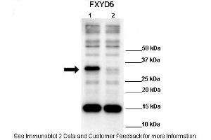 Lanes:   Lane 1: 10ug hFXYD5 transfected 293T lysate Lane 2: 10ug 293T lysate  Primary Antibody Dilution:    1:1000  Secondary Antibody:   Anti-rabbit HRP  Secondary Antibody Dilution:    1:4000  Gene Name:   FXYD5  Submitted by:   Anonymous (FXYD5 antibody  (N-Term))