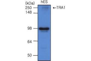 Western blot analysis: The cell lysates of hES(20ug) were resolved by SDS-PAGE, transferred to PVDF membrane and probed with antihuman TRA 1 (1:500). (GRP94 antibody)