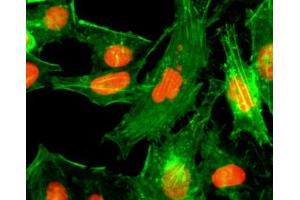 ICC/IF staining of HeLa cells treated with sodium butyrate using recombinant H4R3me1 antibody (red).