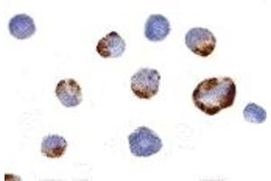 Immunohistochemistry (IHC) image for anti-P21 Protein (Cdc42/Rac)-Activated Kinase 7 (PAK7) (Middle Region) antibody (ABIN1031031) (PAK7 antibody  (Middle Region))