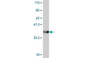 Western Blot detection against Immunogen (37. (Myosin ID antibody  (AA 211-310))