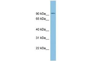 TLK1 antibody used at 1 ug/ml to detect target protein. (TLK1 antibody  (Middle Region))