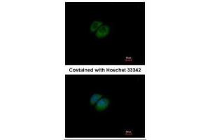 ICC/IF Image Immunofluorescence analysis of methanol-fixed A549, using HPRT, antibody at 1:500 dilution. (HPRT1 antibody)
