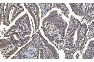 IHC analysis of HDAC5 using anti-HDAC5 antibody (ABIN7599922). (HDAC5 antibody  (AA 13-1107))