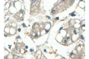 Immunohistochemical analysis of paraffin-embedded human fetal liver showing cytoplasmic staining with ABCF3 polyclonal antibody  at a 1 : 100 dilution. (ABCF3 antibody  (AA 442-681))
