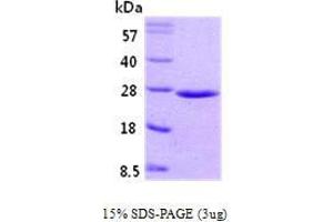 Figure annotation denotes ug of protein loaded and % gel used. (RAB5 Protein (AA 1-215))