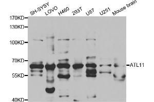Western blot analysis of extracts of various cell lines, using ATL1 antibody (ABIN5973048) at 1/1000 dilution. (ATL1 antibody)