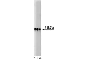 Western Blotting (WB) image for anti-A Kinase (PRKA) Anchor Protein 5 (AKAP5) (AA 180-427) antibody (ABIN967900) (AKAP5 antibody  (AA 180-427))