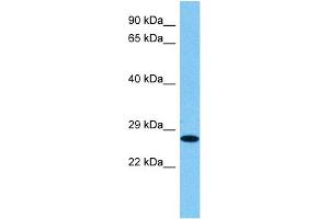 Host:  Rat  Target Name:  HMGB1  Sample Tissue:  Rat Skeletal Muscle  Antibody Dilution:  1ug/ml (HMGB1 antibody  (N-Term))