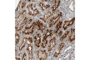 Immunohistochemical staining of human kidney with SUSD2 polyclonal antibody  show strong cytoplasmic and membranous positivity in cells in tubules at 1:200-1:500 dilution. (SUSD2 antibody)