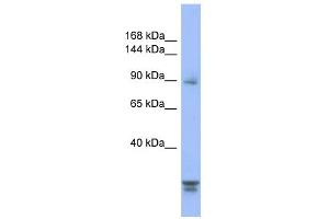 WB Suggested Anti-PPP2R3A Antibody Titration: 0.