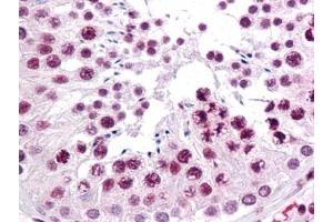 Immunohistochemistry (IHC) image for anti-Sirtuin 1 (SIRT1) (AA 456-555) antibody (ABIN614713) (SIRT1 antibody  (AA 456-555))