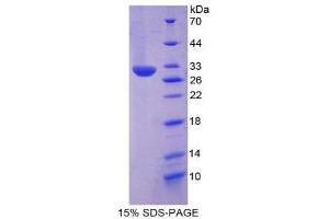 SDS-PAGE (SDS) image for Paxillin (PXN) (AA 327-568) protein (His tag) (ABIN2126231)