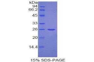 SDS-PAGE analysis of Human Nucleolin Protein. (Nucleolin Protein (NCL))