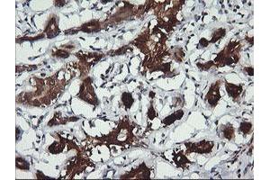 Image no. 2 for anti-butyrobetaine (Gamma), 2-Oxoglutarate Dioxygenase (Gamma-butyrobetaine Hydroxylase) 1 (BBOX1) antibody (ABIN1496819) (BBOX1 antibody)