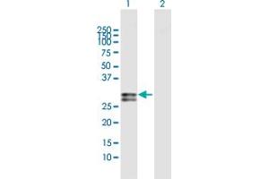 Western Blot analysis of OSM expression in transfected 293T cell line by OSM MaxPab polyclonal antibody. (Oncostatin M antibody  (AA 1-252))