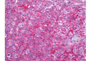 Anti-B2M antibody IHC of human tonsil. (beta-2 Microglobulin antibody)