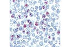 IHC analysis of FFPE human spleen tissue stained with LIN28B antibody