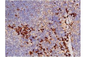 Immunohistochemistry (IHC) image for anti-Microtubule-Associated Protein tau (MAPT) (pThr212) antibody (ABIN6256508)