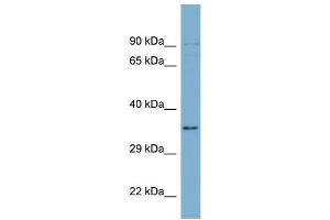 WB Suggested Anti-UBXN1  Antibody Titration: 0.