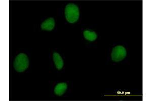 Immunofluorescence of purified MaxPab antibody to ORC3L on HeLa cell. (ORC3 antibody  (AA 1-712))