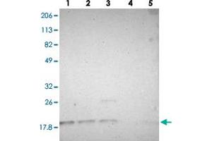 Western blot analysis of lane 1: RT-4, lane 2: U-251 MG, lane 3: A-431, lane 4: Liver and lane 5: Tonsil using SUB1 polyclonal antibody . (SUB1 antibody)